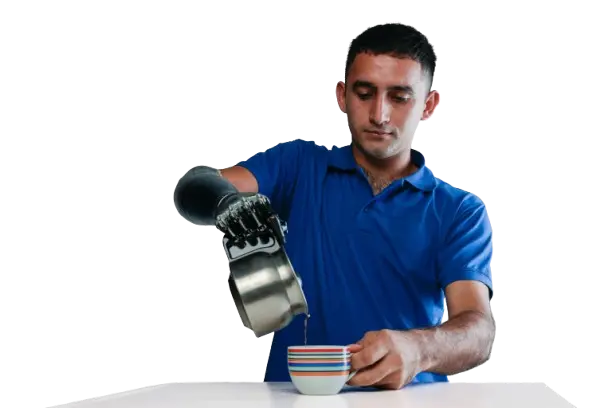Paciente utilizando prótesis de miembro superior